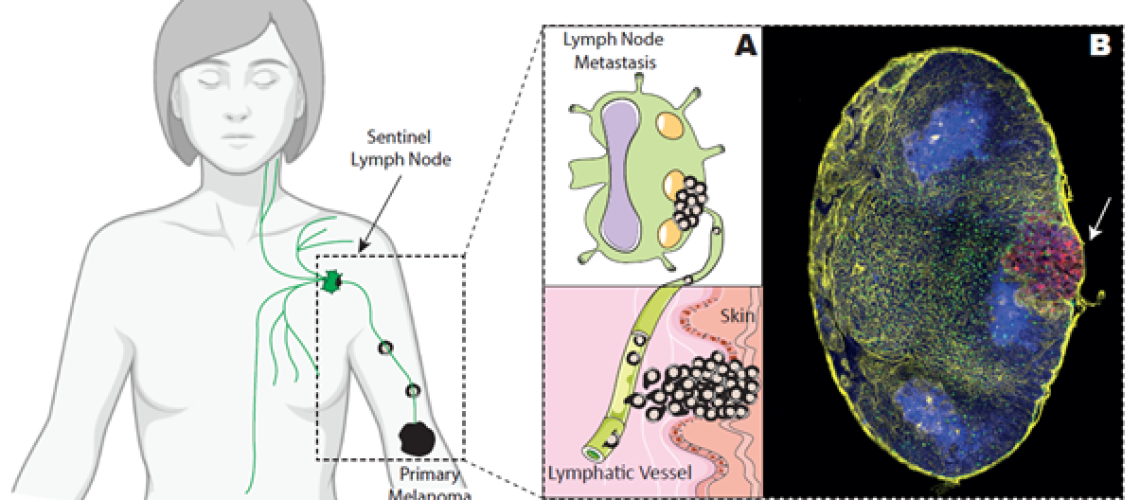 Melanoma Cells (SFG Lab)