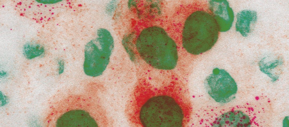 foto_1_Nature-Immunology_MGUJan2022