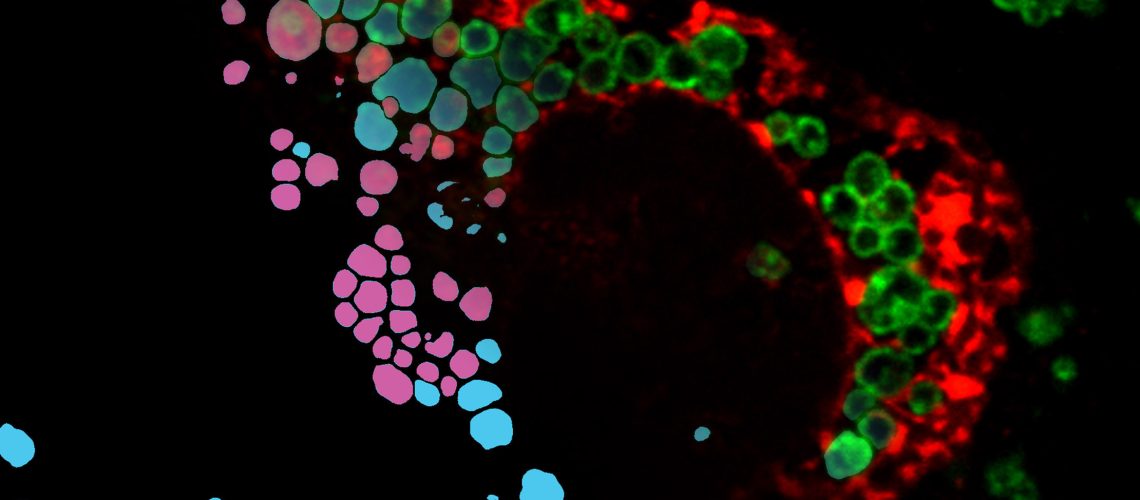 Endolysosomal compartments maintain cellular fitness by clearing from cells dysfunctional organelles and proteins. Quantification of cargo delivery to and/or accumulation within endolysosomes is instrumental to characterize lysosome-driven pathways at the molecular level and to monitor consequences of genetic or environmental modifications. LysoQuant provides fast recognition with human-level accuracy of fluorescence images capturing cargo delivery within endolysosomes, thus weakening the boundary between the worlds of manual accurate annotation and high-throughput screenings.

Credits: Diego Morone, Alessandro Marazza, Timothy J. Bergmann, Maurizio Molinari - Institute for Research in Biomedicine, Switzerland